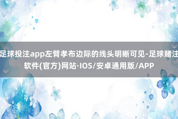 足球投注app左臂孝布边际的线头明晰可见-足球赌注软件(官方)网站·IOS/安卓通用版/APP